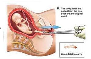 人流孩子图片,孩子眼中的世界
