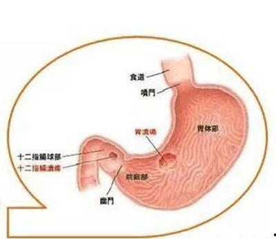 明星胃溃疡,揭秘明星胃溃疡背后的故事